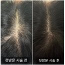 머리에반하다 | [머리에반하다홍대점] 홍대 헤어증모술 후기와 유지력, 리터치 후기와 주기