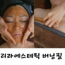 제2리라유치원 | 성서피부관리 리라에스테틱 버닝필 관리 솔직후기
