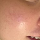 청담글래시피부과의원 이미지