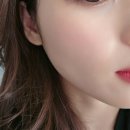 예쁨의정석의원 | 송도 피부과 점빼기 내돈내산 후기, '예쁨의정석의원' 송도 8공구 피부과 추천! (기미, 잡티, 색소침착...