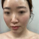 송파 문정동 _ 프리미엄 위례에스테틱 위례피부관리 1:1 맞춤관리[주피에뜨]