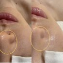 헤르헤르 | 남천동 에스테틱 스파헤르 트라이엄 관리 솔직후기