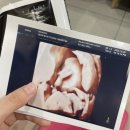 바른치킨(광혜원점)
