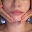 강스킨바디 | 당산역 피부관리, 디오스킨앤바디에서 윤곽관리 후기!