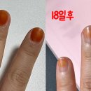 살포시 물든 손톱 | 다이소 봉숭아물들이기 여름준비하기