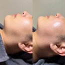 한국병원 | 광주 쌍촌동 피부관리 르헤브 스킨케어 프리미엄 리프팅 알테온 후기