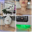 대전피부관리 저자극 시술 밀크필 후기 뷰티끄라윤