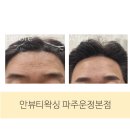 도도라인 왁싱 파주운정본점 | 운정왁싱샵 안뷰티왁싱 파주운정점 헤어라인 왁싱 후기