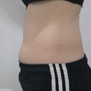 (주)압구정하루 | 압구정역 피부과 추천 강남 다이어트 복부주사 내돈내산 가격 효과 후기