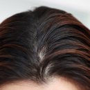 다나메드 이미지