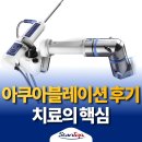 아쿠아블레이션 후기 비용도 중요하지만 치료의 효과도 중요합니다