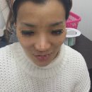솔헤어라인