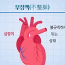 부정맥 초기 원인 및 심장 부정맥에 좋은 운동 이미지