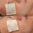 스무살에머물다 석림점 | 서산 피부관리 스무살에 머물다 서산석림점 남자 갈바닉 후기