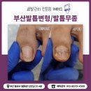 미리케어스