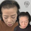 에테르노 | 부산두피문신잘하는곳 에테르노 자연스러운 변화 후기