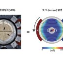 자기장 이용해 뇌 수술 없이 파킨슨병 치료한다 이미지