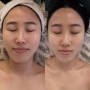부산웨딩관리 해운대 승모근관리 잘하는 마린시티 올댓스칼프앤스킨라운지