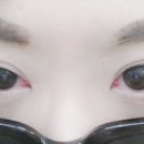 칠곡대구안과의원 네이버블로그