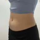 상상보다 어렵지않은 다이어트의원 후기 2