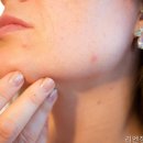 인천피부과 리엔장의원 인천 피부 고민 해결의 시작