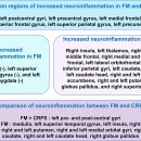 fibromyalgia, CRPS 통증 기전 최신논문 탐구!! 이미지