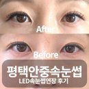 린온 | 안중속눈썹연장 린온뷰티 평택 LED속눈썹연장 후기