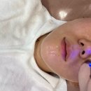 뷰티kim | 부평 피부관리ㅣ매끈 피부관리 김태희 뷰티샵, 첫 스킨플래닝, 하이푸리프팅 후기