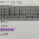 ekg 잘보는 간호들아 지발 도와줘 이미지