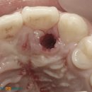 자라진천 이미지