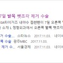 하부골 이미지