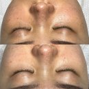 [말.잘.알] 말의 결 (당당하게 말하지만 상처 주지 않는) | 한 달로 효과 본 홈 케어 관리법 + 내 돈 내산 올영추천템 소개(잡티 요철 미백 고민 피부)