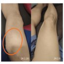 연산보건지소 | 연산역한의원? 30년간 꾸준히 입소문으로 찾는 곳의 비밀 1가지.