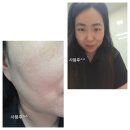 비피바이오 | 바이오드론 시그니처 스킨 프로텍터 후기(제품 제공)