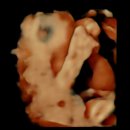 🤰 임신 30주차 정기검진 후기｜정기검진 후 햄버거로 채운 하루의 기록