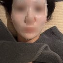 송 외과 | 송도 라베 성형외과 시술 솔직후기 | 하이드라페이셜