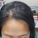 소곡 | 안양 만안구미용실 큐사랑 소곡점 탈모관리 안양 두피관리