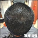 선명이용원 | 광주전남 정수리탈모 고민 끝! 두피페인팅을 아직도 모르시나요?