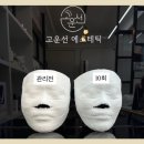 선 에스테딕 네이버블로그