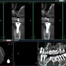 덴토피아치과의원 이미지