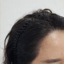 프로닷스칼프