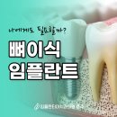 충주하나치과의원 네이버블로그