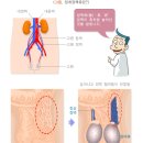 마리아비뇨기과 네이버블로그