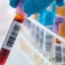 일반 혈액검사/전혈구조사 (CBC, Complete Blood Count) 이미지
