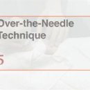 Placement of an Arterial Line 이미지