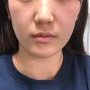 젠블리 라라 이미지