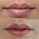 피그만클리닉 이미지