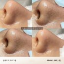 미크리닝샵 | 봉천동피부관리 잘하는 봉천동피부샵, 프롬미서울대입구역점 블랙헤드 안정정화 케어