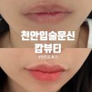 올리브영진해하나로마트점 | 천안입술문신 후기｜입술 착색 고민, 자연스러운 핑크립으로 달라진 청당동 캄뷰티 틴트립