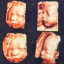 제이에스카케어 | [Baby.8] 임신 중기 27주차~30주차 증상
